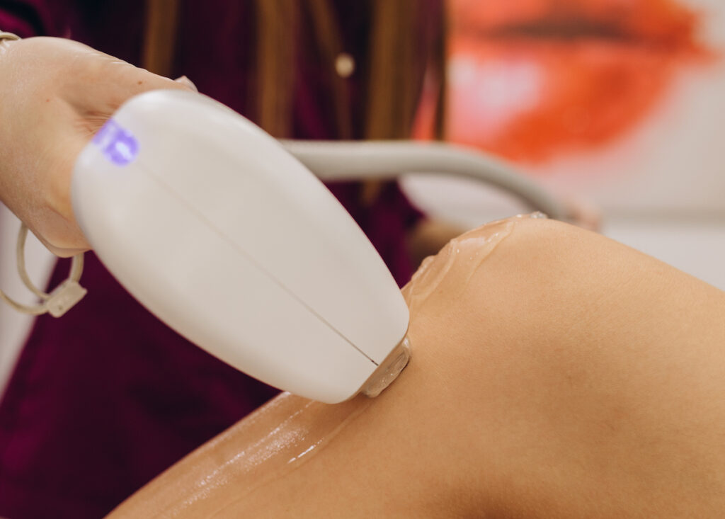 A woman is lying down while a technician holds a device against her leg for laser hair removal in Frisco.